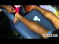 Performance Taping with Toronto Chiropractor